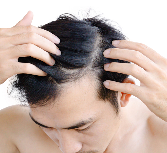 A Guide to Hair Loss: Risk Factors, Diagnosis, and Prevention